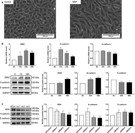 Ron Induces Emt In Endometrial Epithelial Cells A Morphology Of