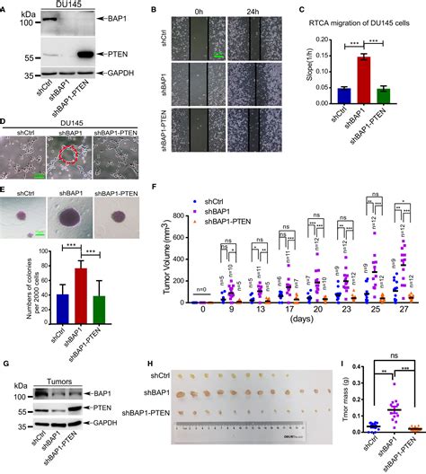 BAP1 Suppresses Prostate Cancer Progression By Deubiquitinating And