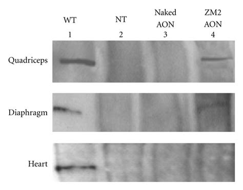 Western Blot Analysis Immunoblotting For Dystrophin Using Dys