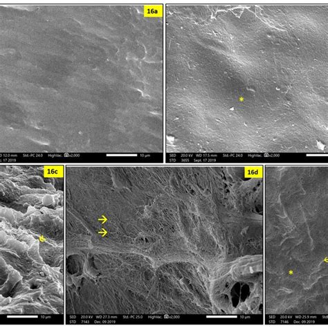 A E Higher Magnification Of Scanning Electron Photomicrographs Of