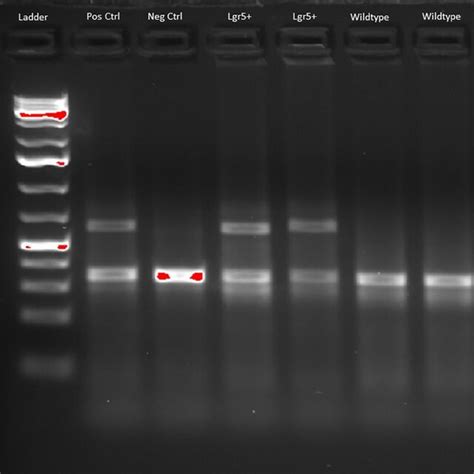 Pcr And Immunohistochemistry Of Lgr A Representative Pcr Gel Lane