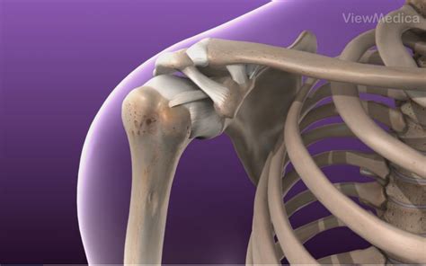 instability-of-the-shoulder - Plano Orthopedic & Sports Medicine Center