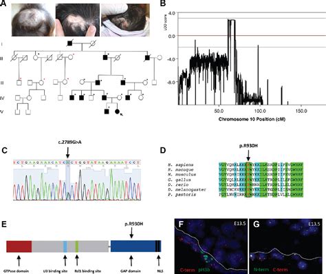 Figure 1 From BMS1 Is Mutated In Aplasia Cutis Congenita Semantic Scholar