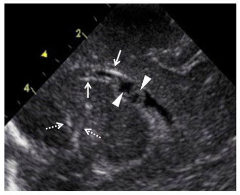 Diagnostics Free Full Text Fetal Ultrasound And Magnetic Resonance