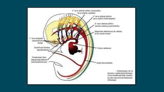 Presentacion Sindrome De Digeorge PPT