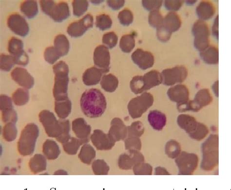 Figure 1 From Leukocytes Detection Classification And Counting In