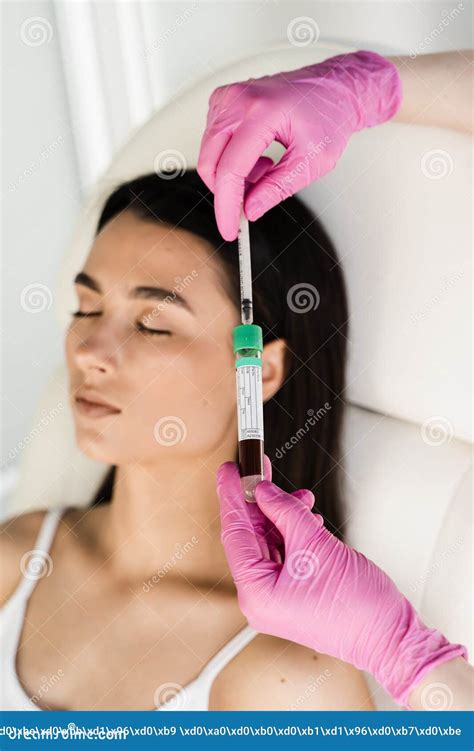 Cosmetologist With Test Tube With Blood And Plasma For Prp Platelet