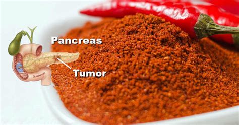 Capsaicin Stops Heart Attacks And Destroys Cancer Cells