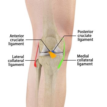 Medial Patellofemoral Ligament Tears Monterey | Knee Instability Carmel