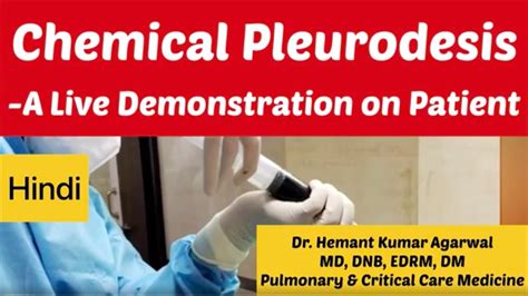 Chemical Pleurodesis A Live Demonstration On Patient Hindi