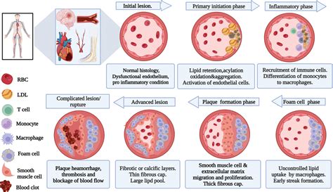 Defining Atherosclerotic Plaque Biology By Mass Spectrometry Based