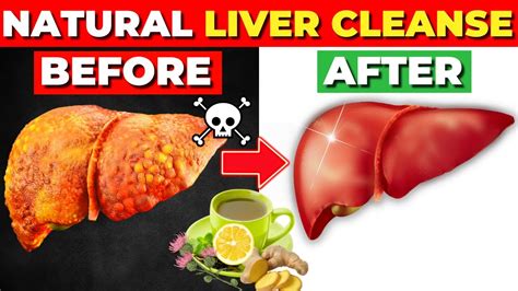 These Superfoods Can Cleanse Fatty Liver Naturally Youtube