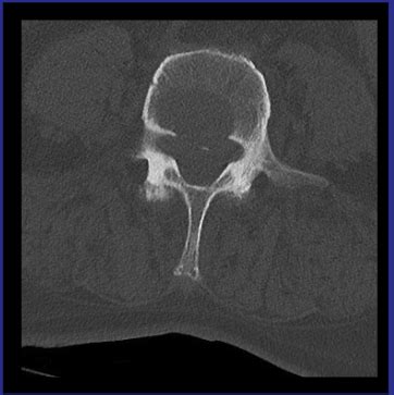 Question 52 MRI Online