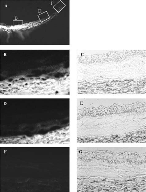 Fluorescence Micrographs And Light Micrographs After Implantation Of