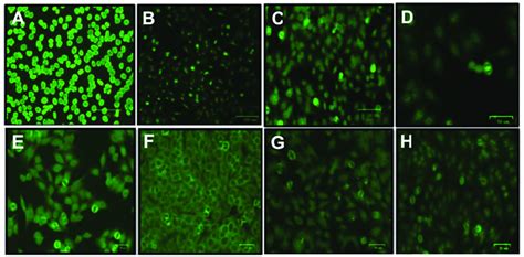 Immunofluorescence Patterns Of Antinuclear Antibodies In Hep 2 Ana