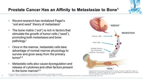 Bone Metastases And Mortality Battle In The Bone