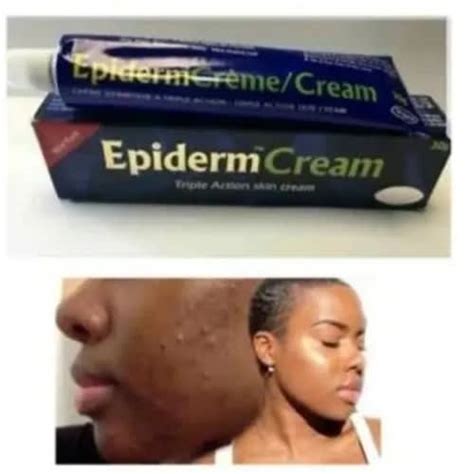 epiderm triple action skin care cream   pcs konga  shopping