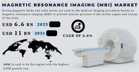 Magnetic Resonance Imaging MRI Market Size Share Trends