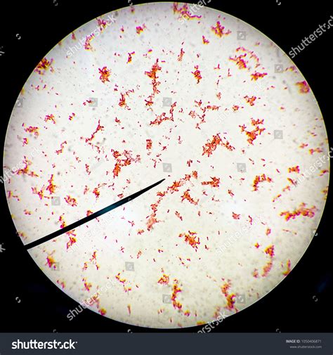 Cholera Bacteria Gram Stain