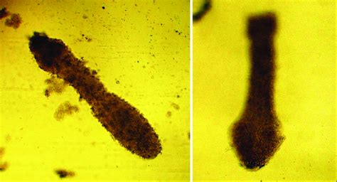 Sexually Mature Echinococcus Granulosus Download Scientific Diagram