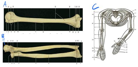 Upper Limb Bony Landmarks Quiz By Murpheycp