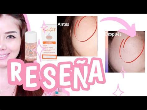 BIO OIL QUITA MANCHAS CICATRICES Y ESTRIAS YouTube