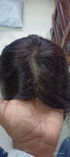 Women Hair Patch at Rs 16000 | ह्यूमन हेयर विग in Bengaluru | ID ...