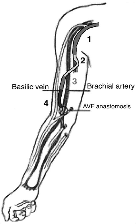 Basilic Vein Anatomy