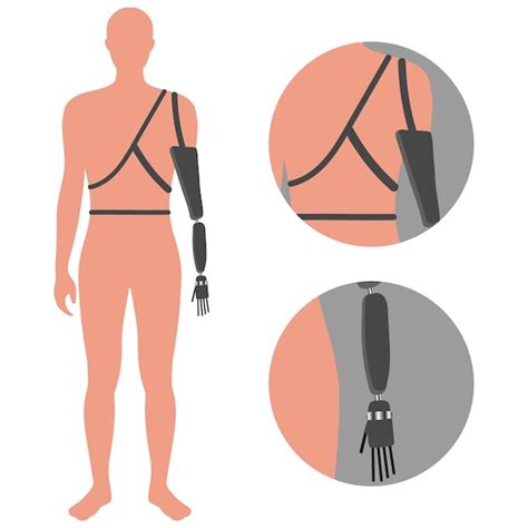 premium vector bionic prosthetic hand