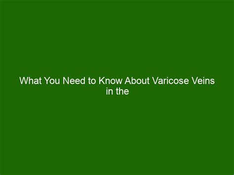 What You Need To Know About Varicose Veins In The Scrotum Health And