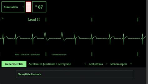 How To Ekg Simulator Quick Manual