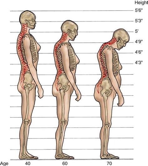 Care Of Patients With Musculoskeletal Problems Nurse Key