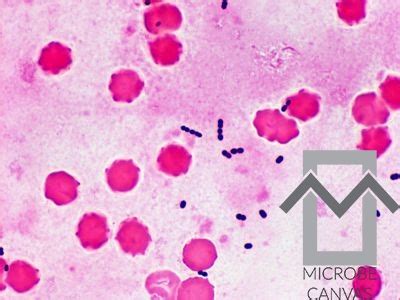 Enterococcus Faecalis Gram Stain Morphology