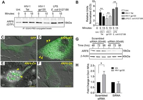 Arf Is Important For Mv Biogenesis From Cerebral Vasculature