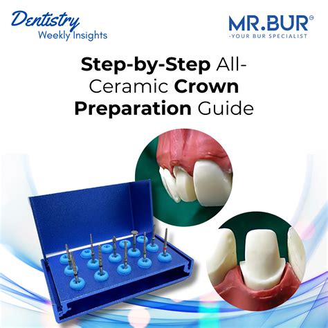 Step-by-Step Guide to All-Ceramic Crown Preparation – Mr Bur