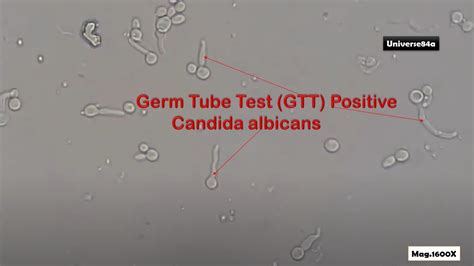 Germ Tube Of Candida Albicans Demonstration Youtube