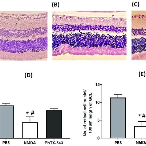 Photomicrographs Of Retinal Sections From Each Group Stained With