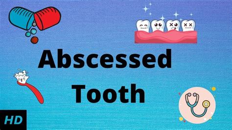 Abscessed Tooth Causes Signs And Symptoms Diagnosis And Treatment Dental Clinic