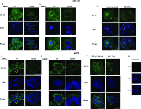 Confocal Microscopy Analysis Of Igf R Nuclear Localization Confocal