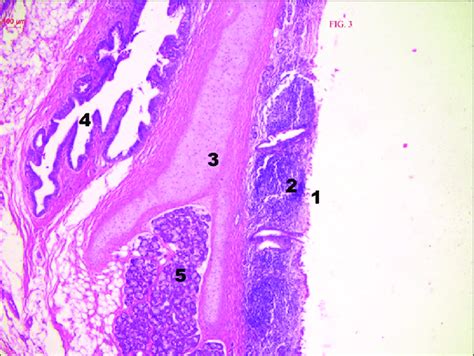 Cross Section Of Tubal Tonsil Showing Lymphoid Tissue Ventral To The