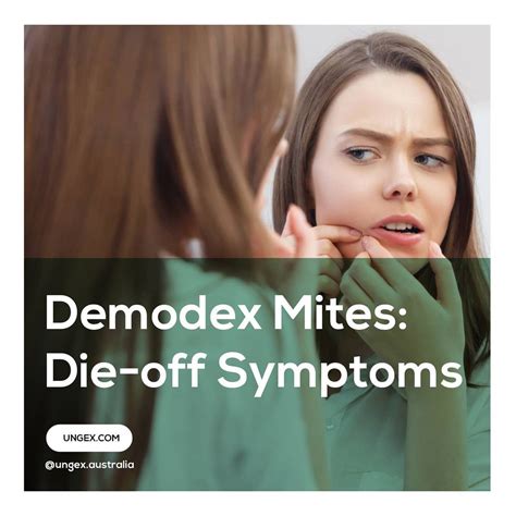 Demodex mites – Artofit