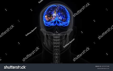 7 Radiography Receptor Images Stock Photos And Vectors Shutterstock