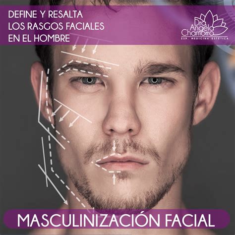 Facial Masculinization Dr Angela Chamorro