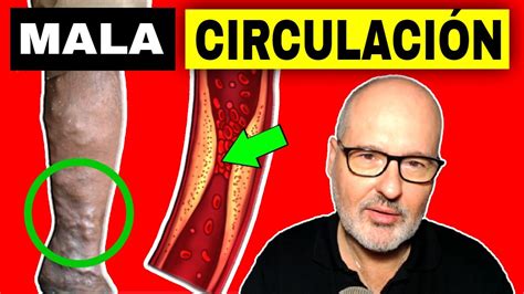 15 Sintomas De Mala CirculaciÓn Y Sus Causas QuÉ Hacer Youtube