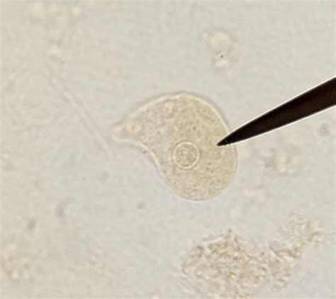 Lab Protozoa Summery And Slides Flashcards Quizlet