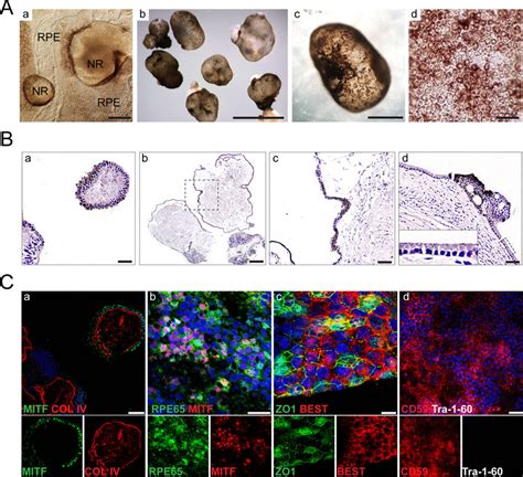 Retinal Pigment Epithelial Organoids Acquired Pigmentation In The