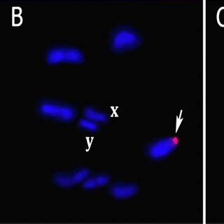 Fluorescence In Situ Hybridization With 18S RDNA Probe A Metaphase II