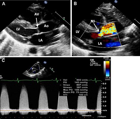 Echocardiography An Overview Part Ii