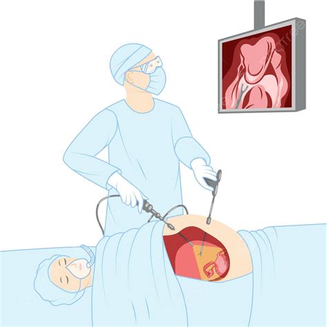 Minimallyinvasive Laparoscopy Surgery Doctor Performing Keyhole Procedure On Female And Male