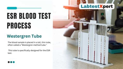 ESR Blood Test Erythrocyte Sedimentation Rate Your Body S Early